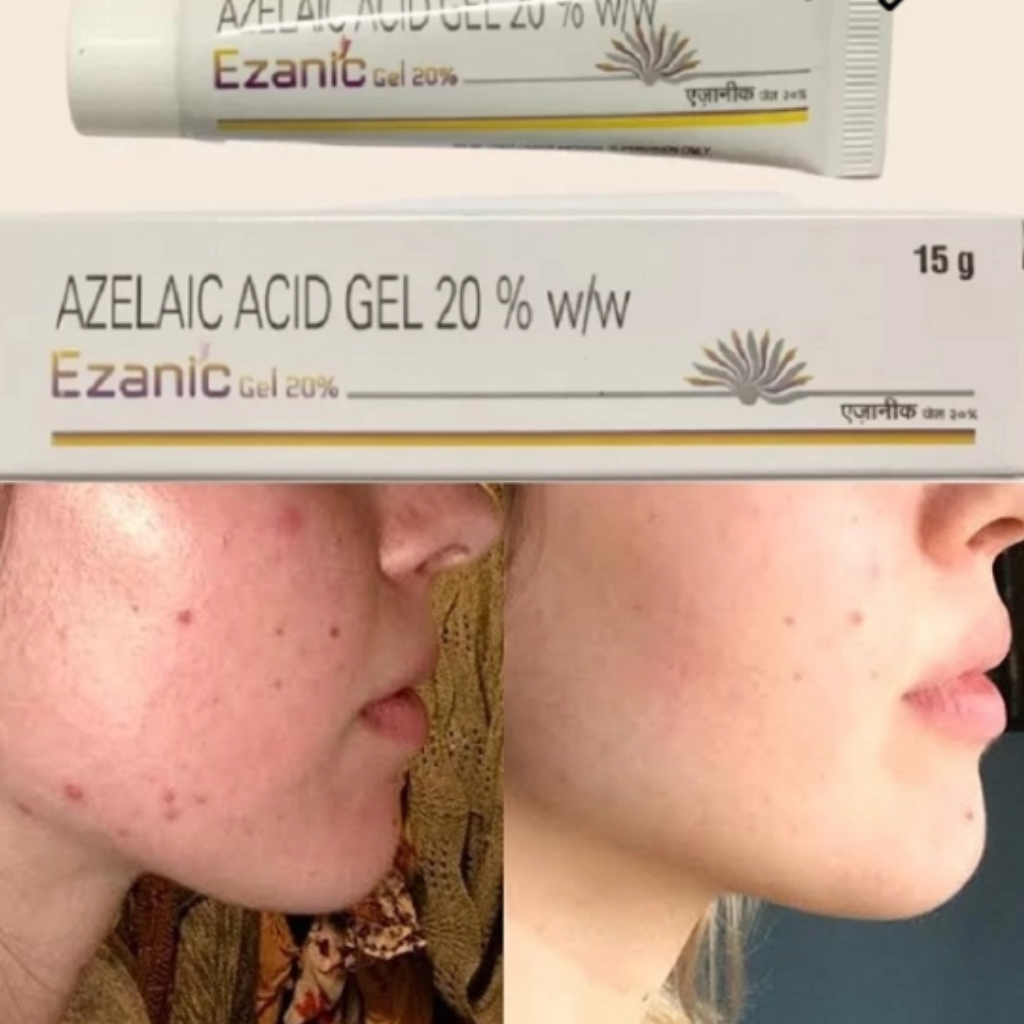 azelaic acid 20