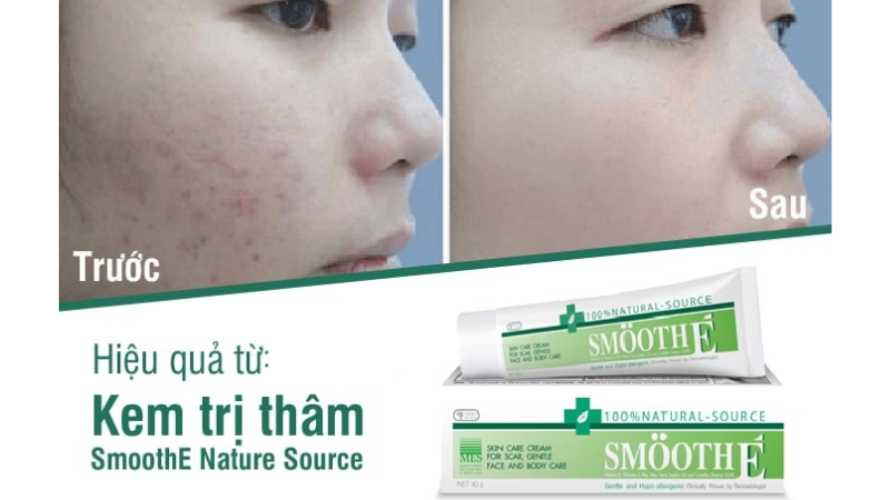 cách sử dụng kem trị thâm smoothe